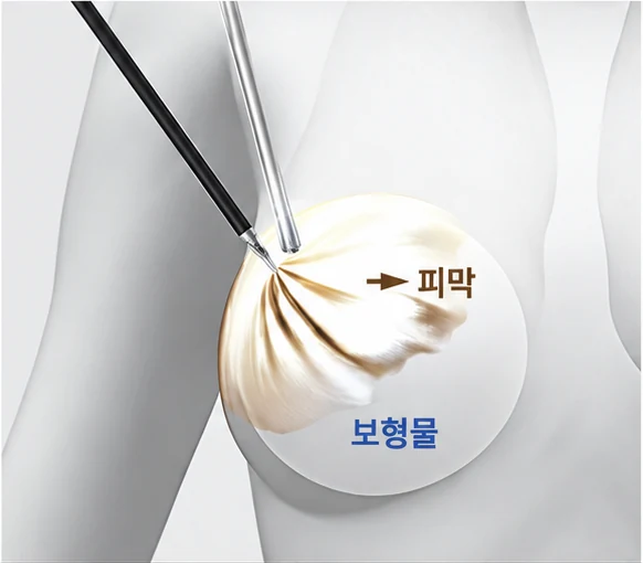 피막 제거 3단계